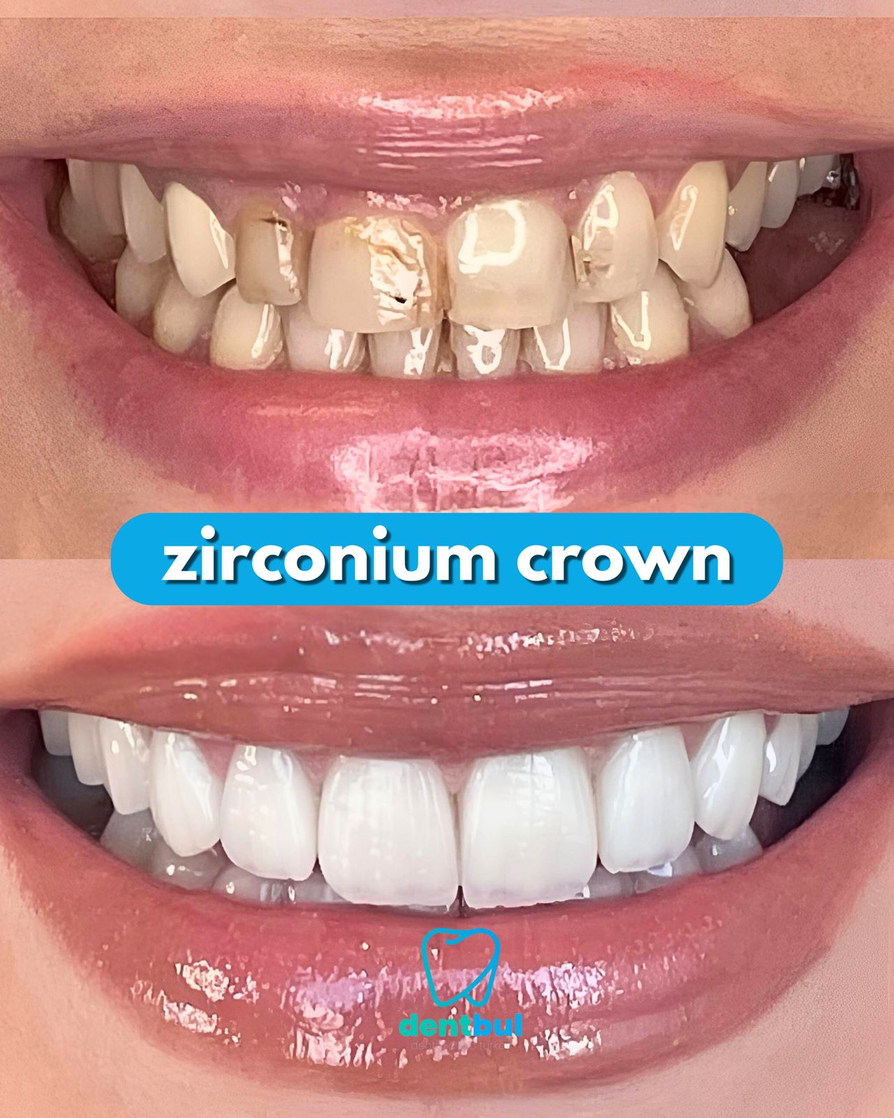 Dental Treatment Result