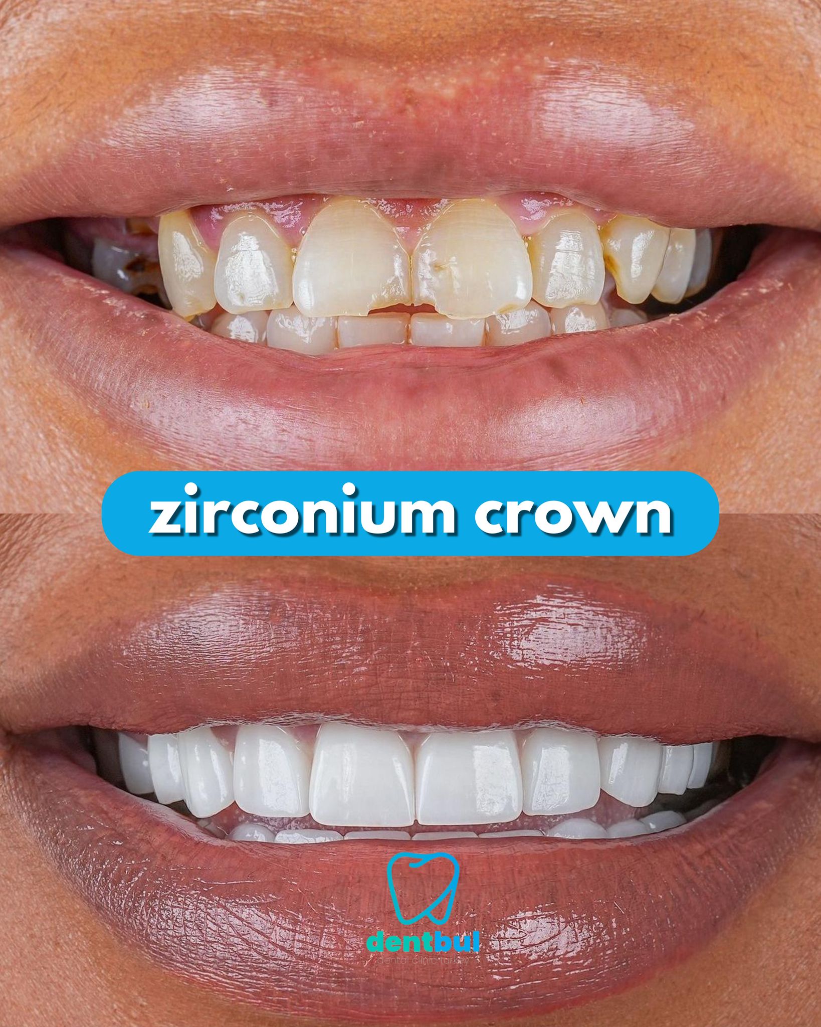 Dental Treatment Result