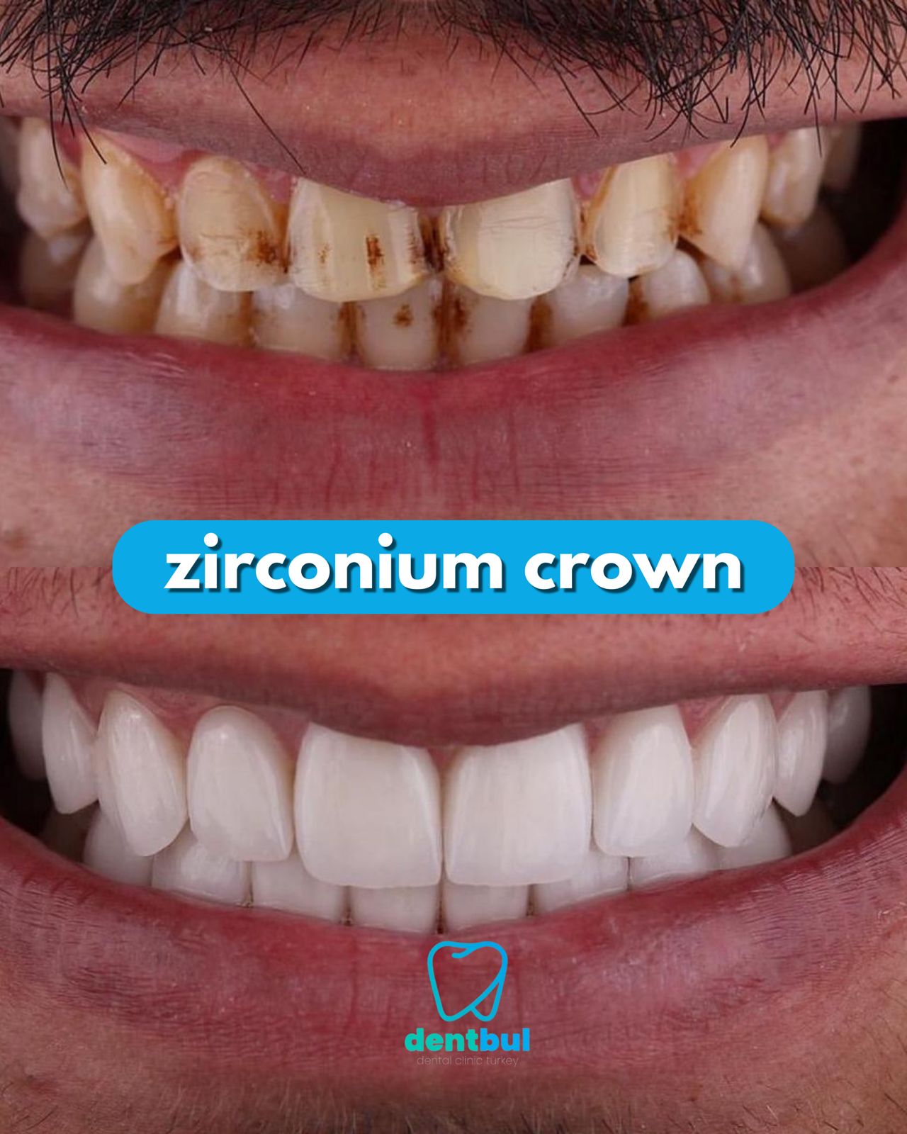 Dental Treatment Result