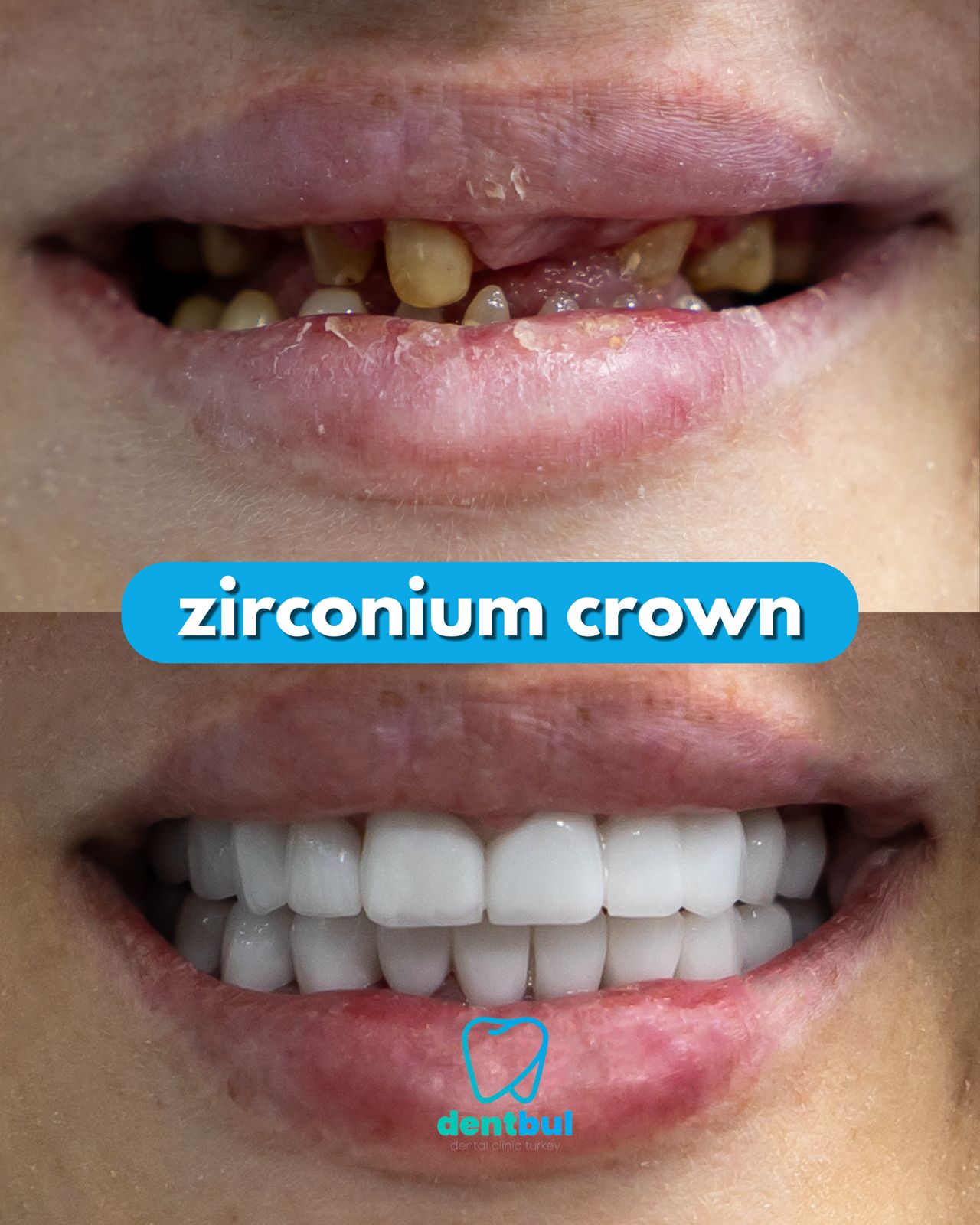 Dental Treatment Result