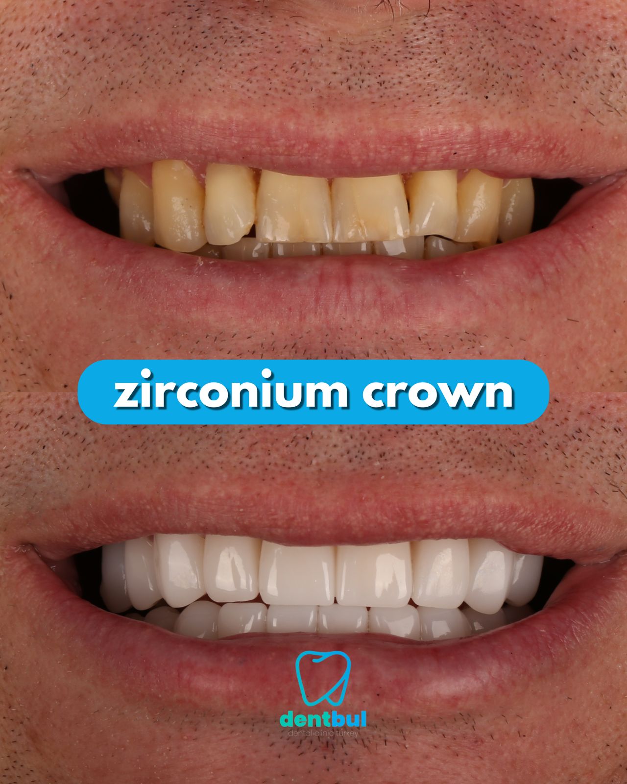 Dental Treatment Result