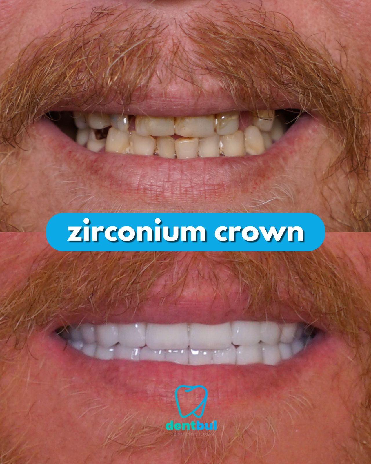 Dental Treatment Result