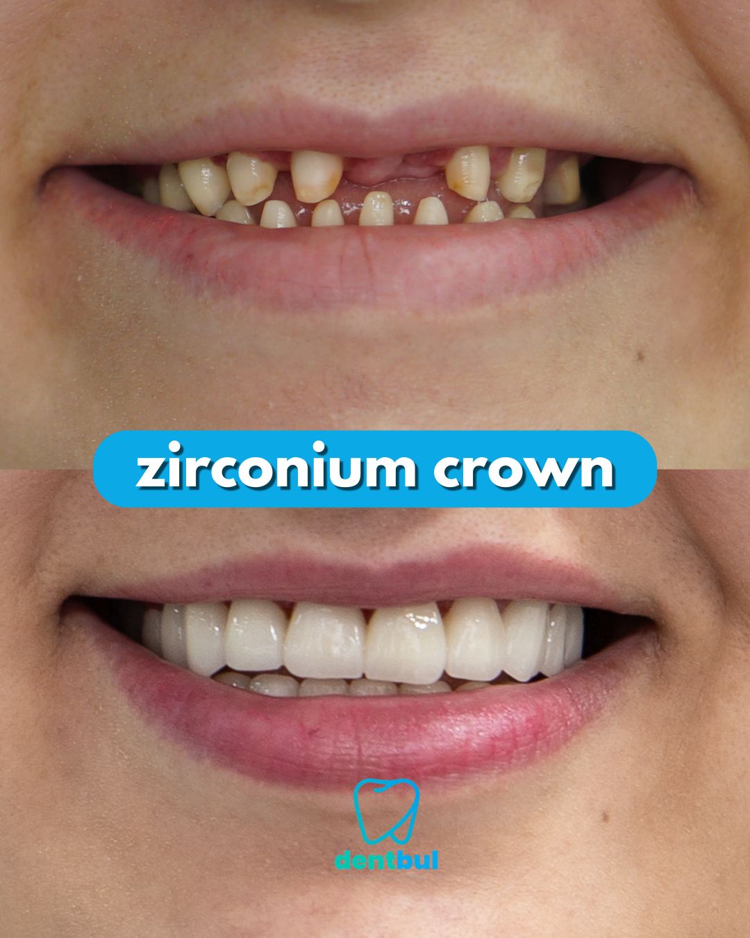 Dental Treatment Result