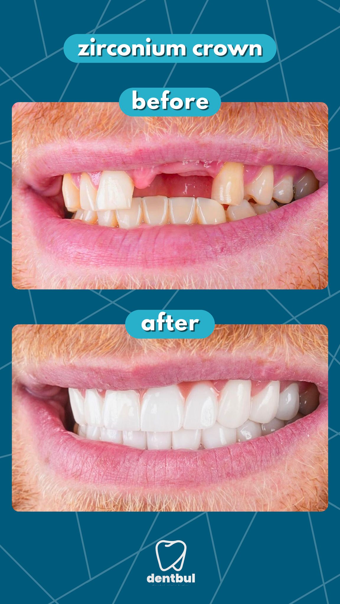 Dental Treatment Result