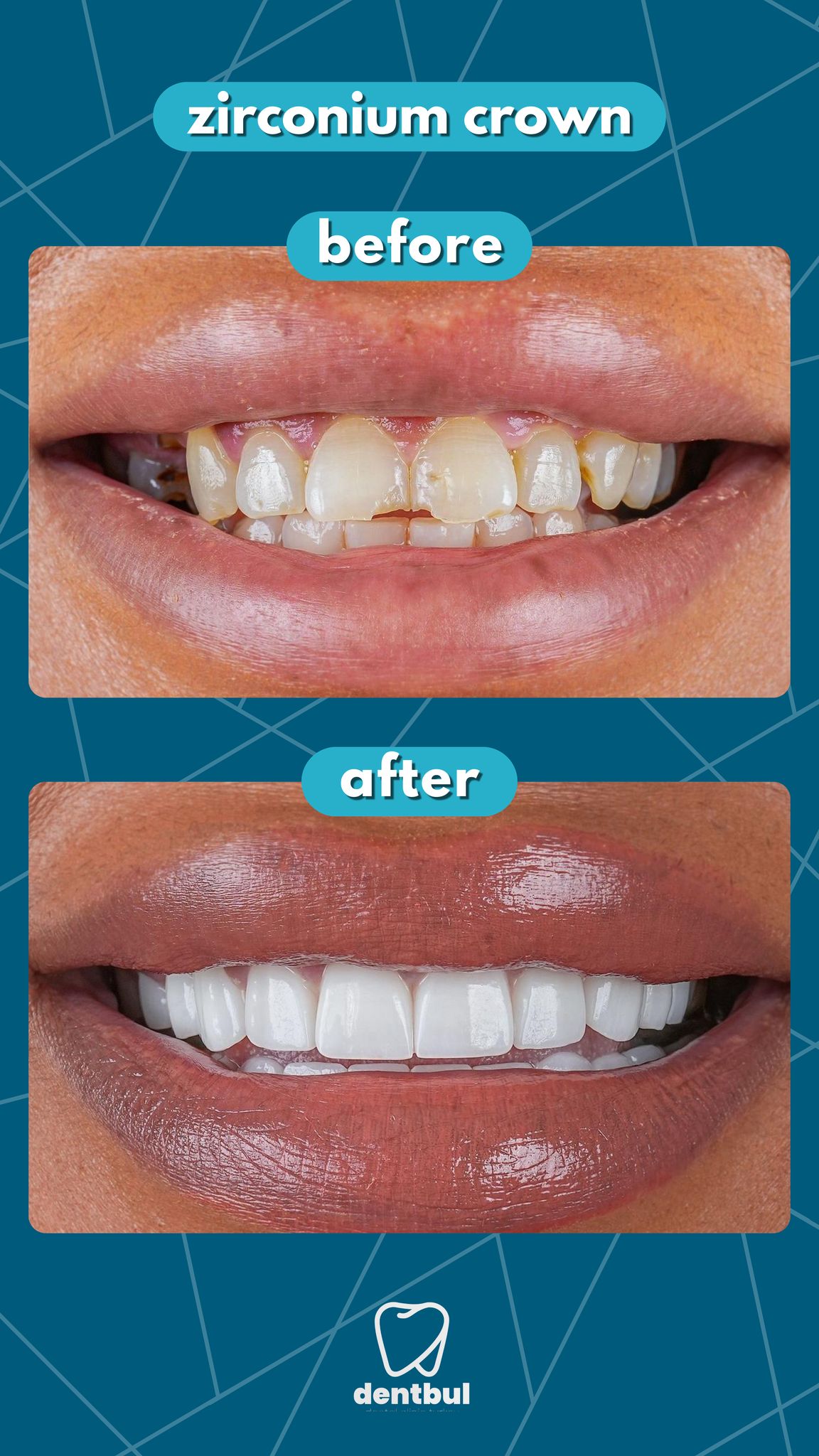 Dental Treatment Result