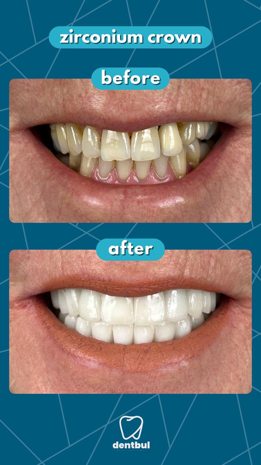 Dental Treatment Result
